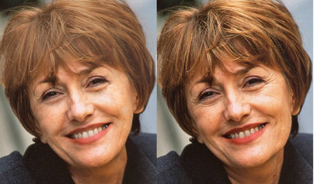 Photo du visage avant et après le contouring